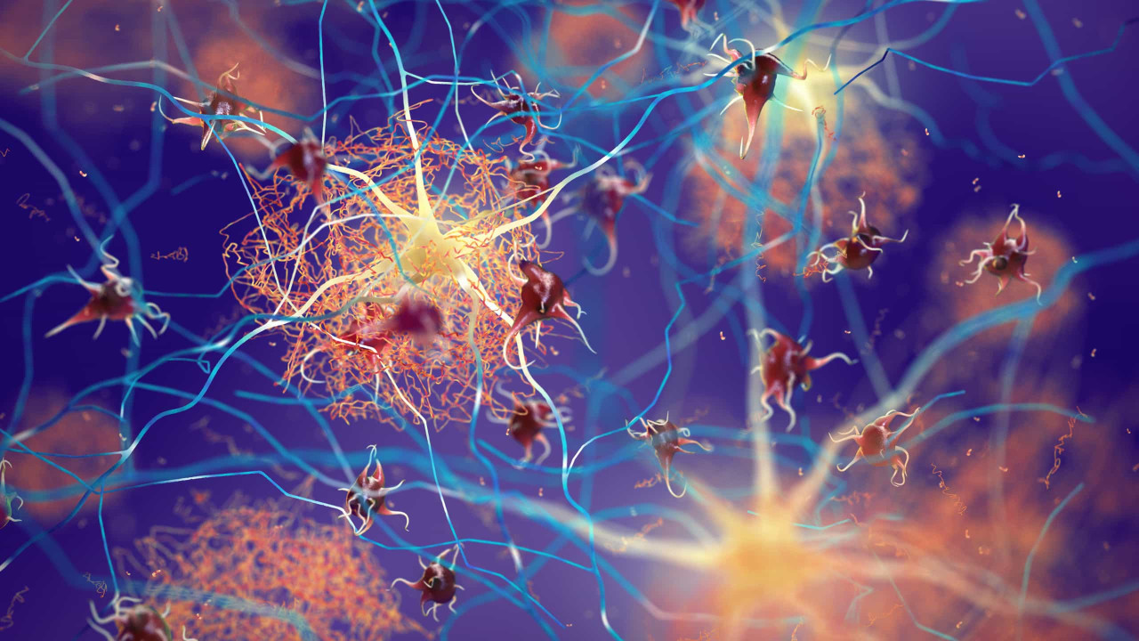 Estudo revela semelhanças entre Covid-19 prolongada e Alzheimer