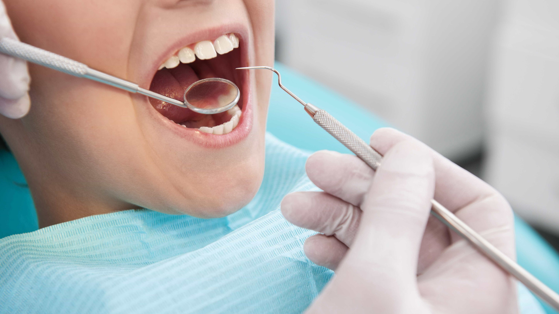 Restaurações dentárias escurecidas devem ser trocadas pelas brancas?