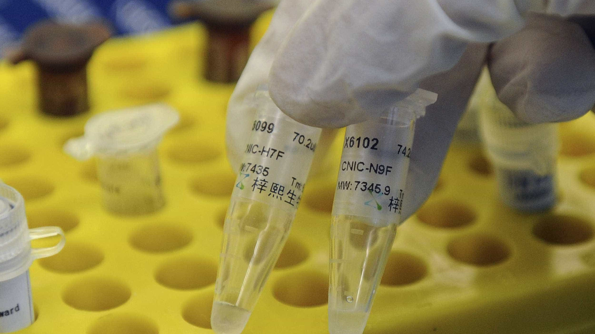 Paciente com suspeita de coronavírus em São Leopoldo tem H1N1