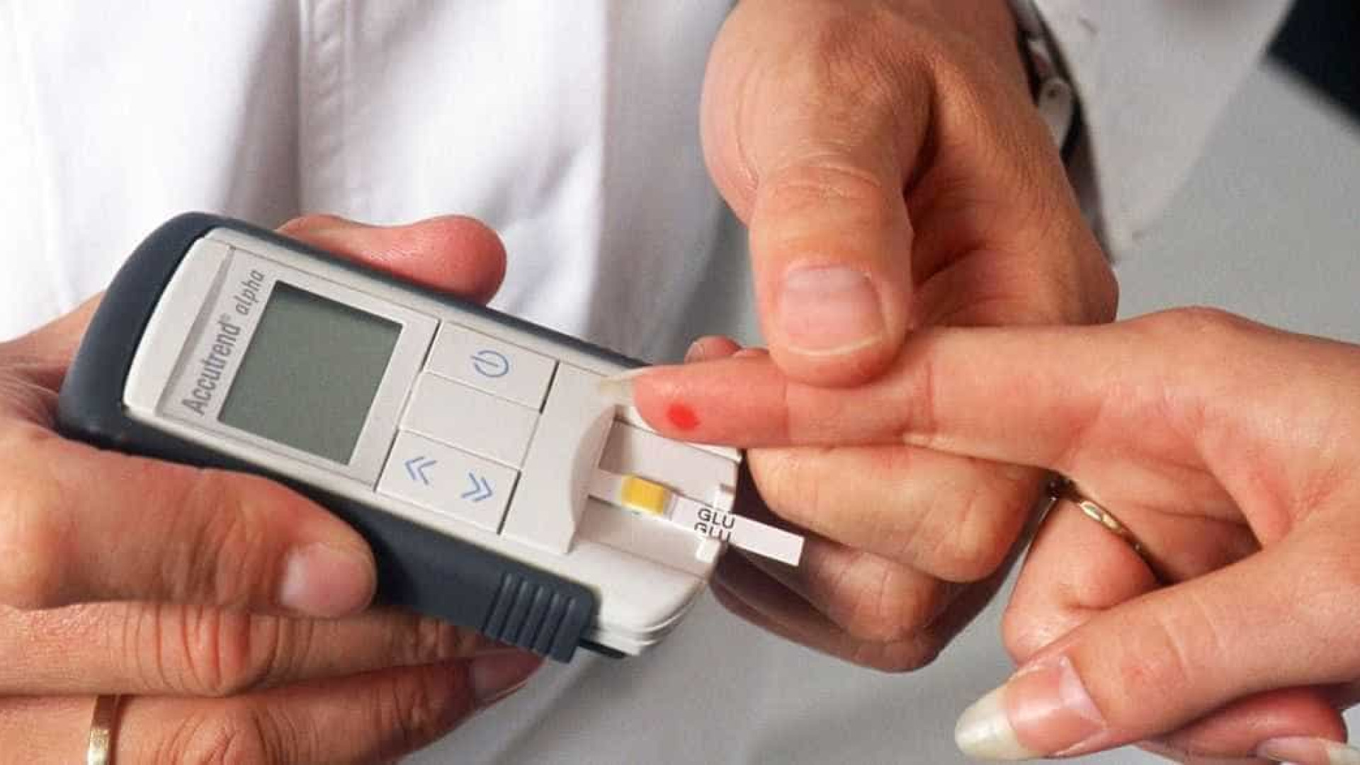 Pesquisadores sugerem teste de colesterol a partir de 25 anos