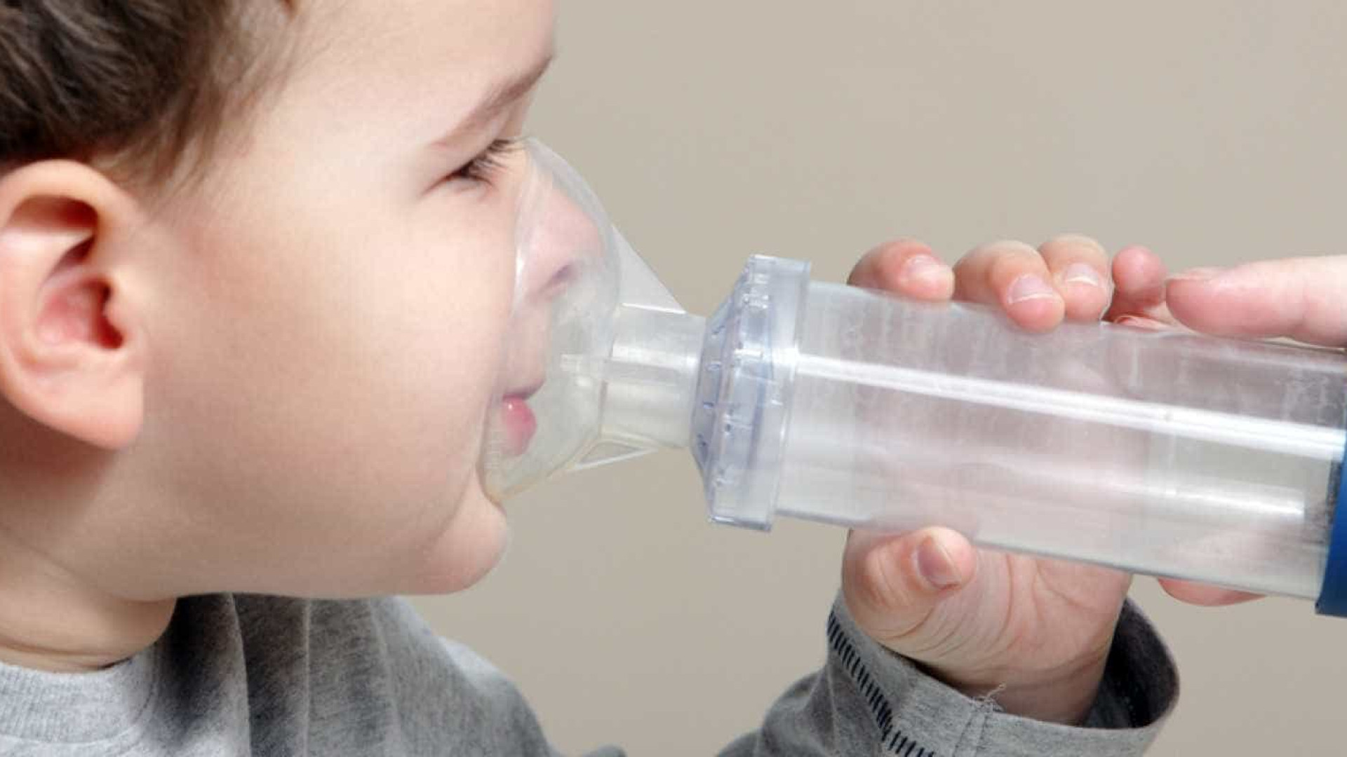 Influenza eleva casos de síndrome respiratória aguda em crianças