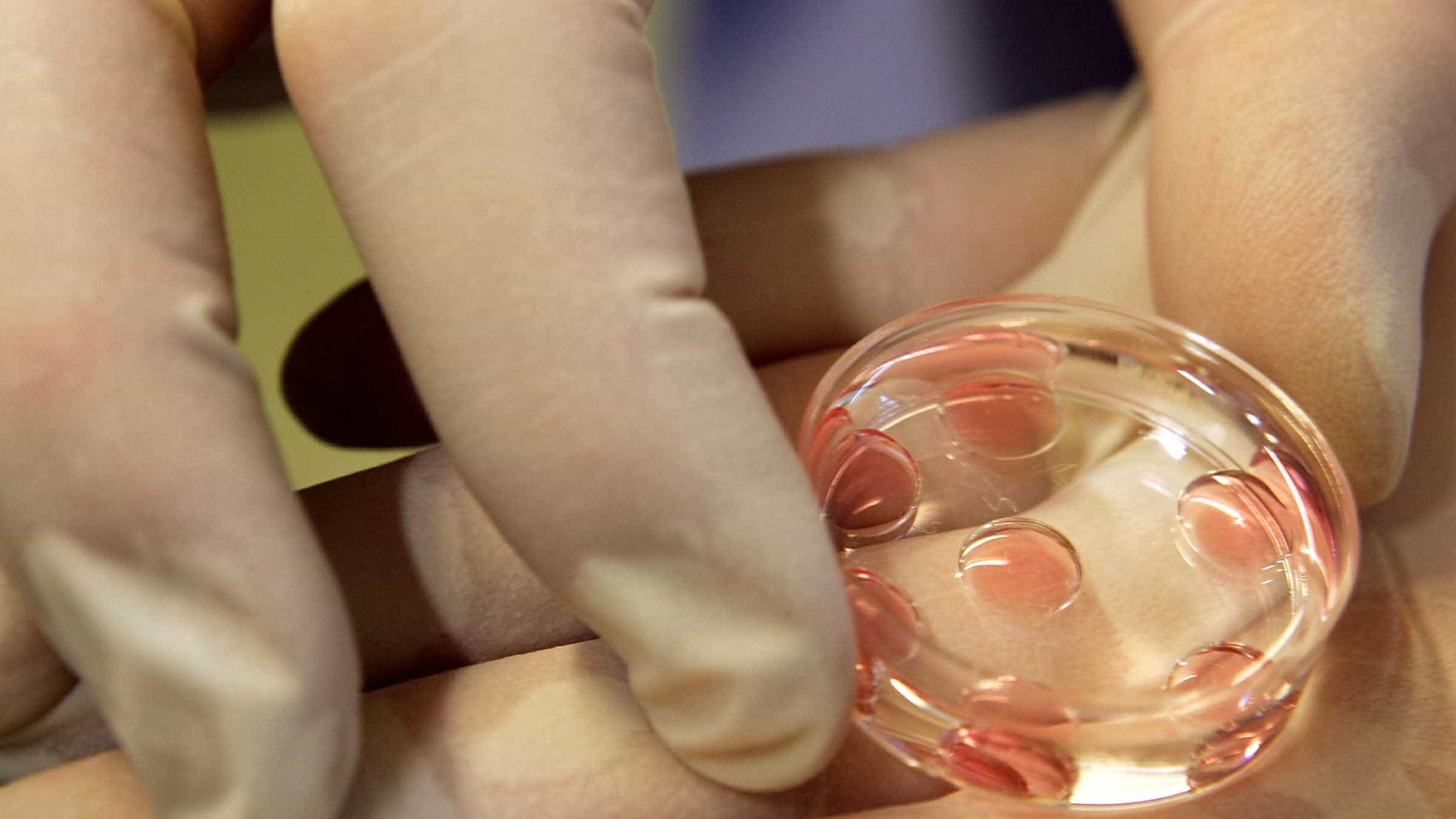 Cientistas testam terapia que usa células do paciente contra câncer