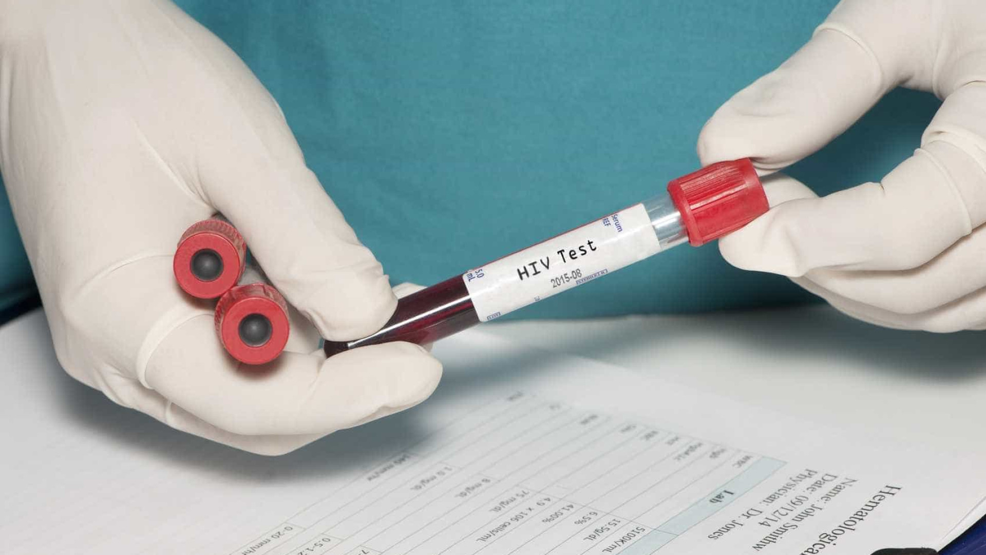 HIV: estudo mostra resistência de mutação a remédio usado no Brasil