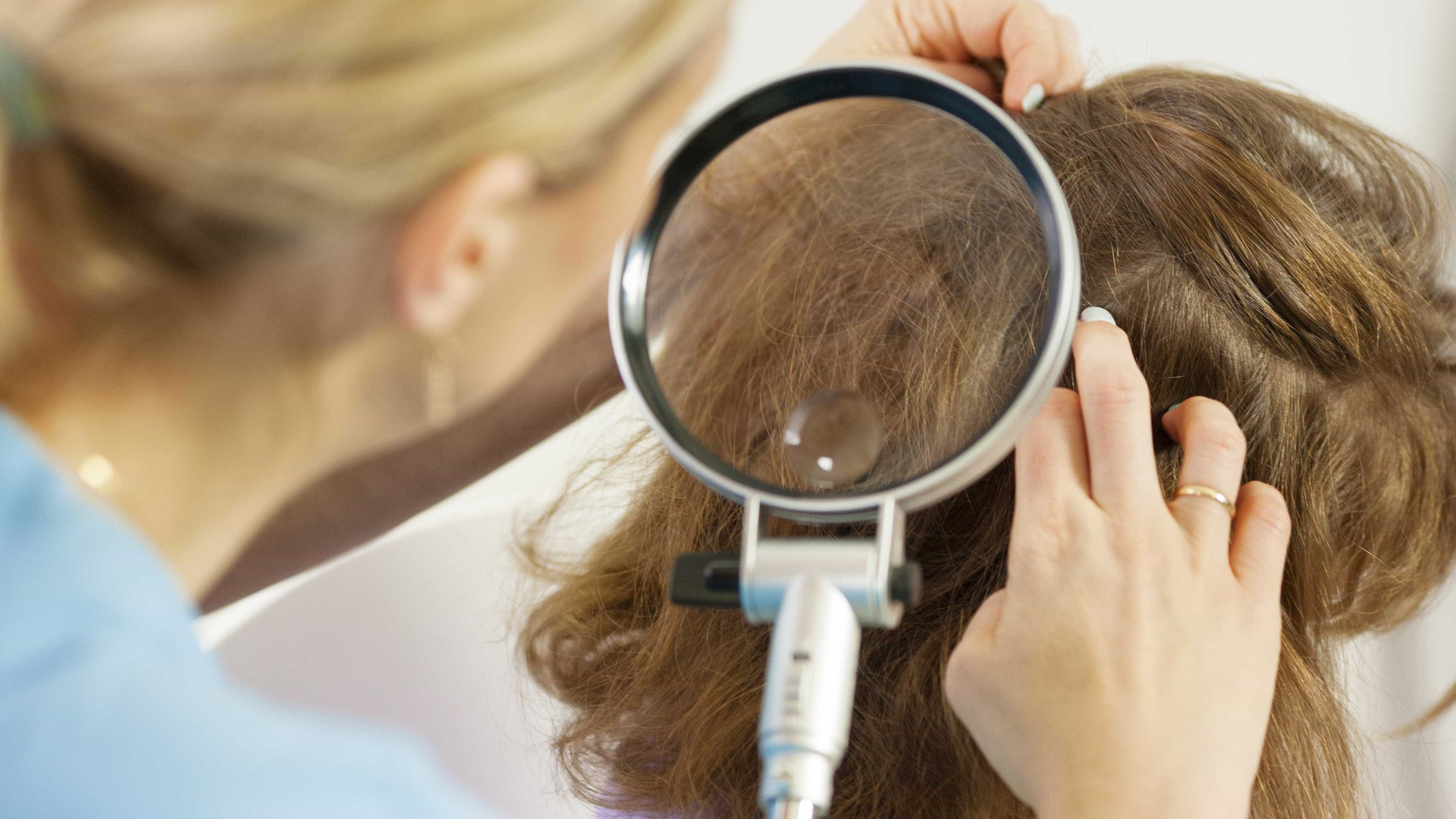 Exame dos fios de cabelo pode indicar
os melhores tratamentos