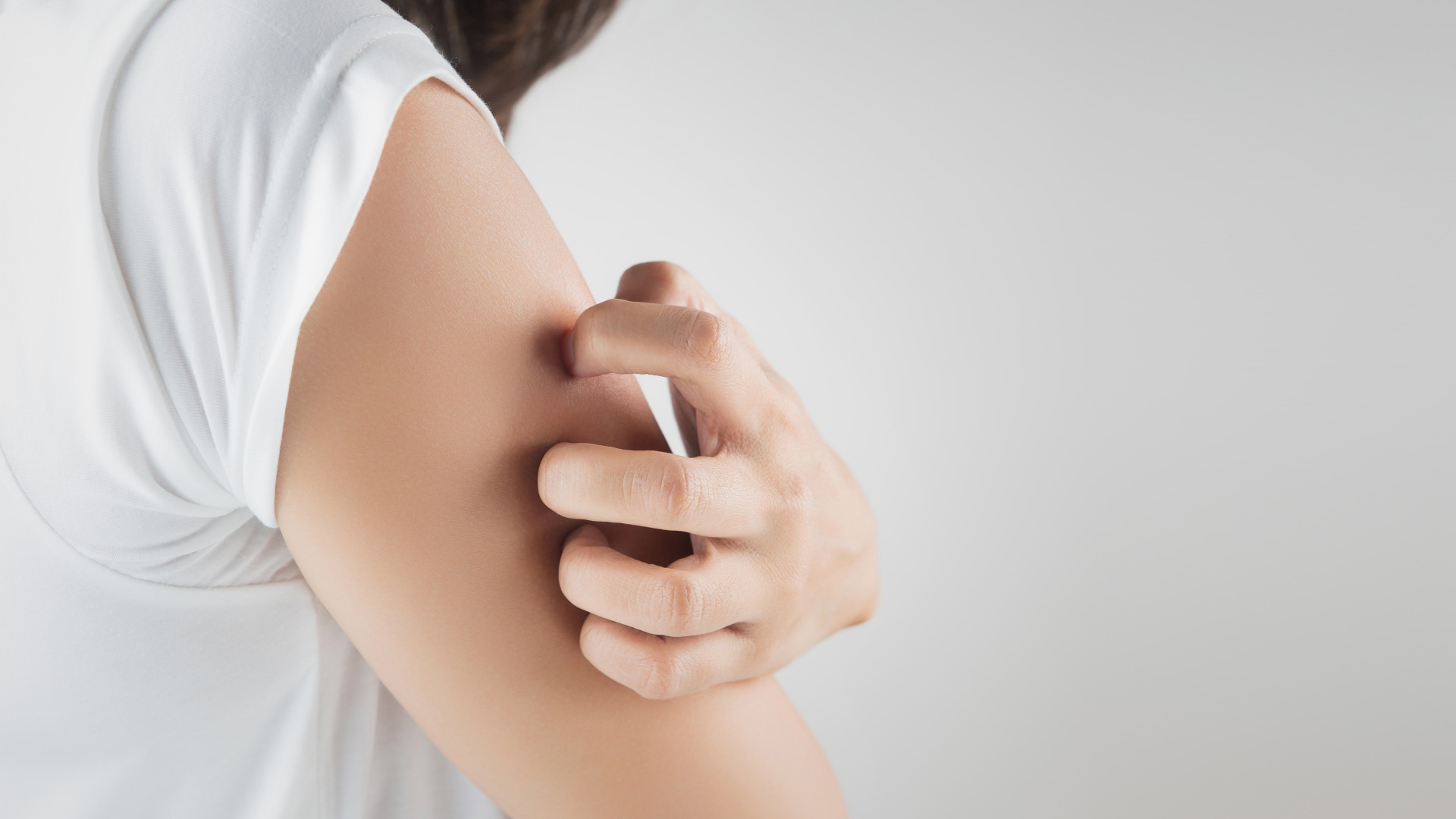Saiba as causas da dermatite seborreica e como evitar a coceira
