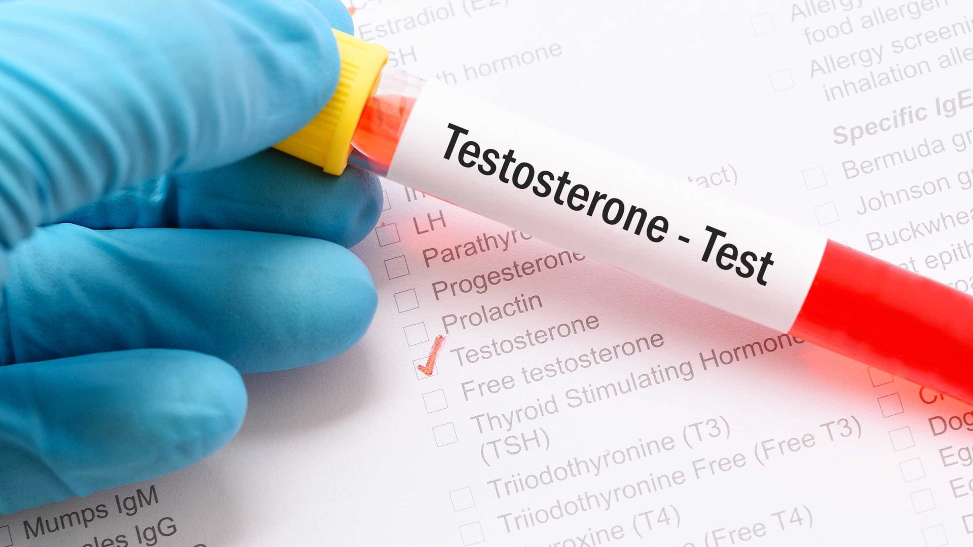 Pesquisa investiga relação entre baixo nível de testosterona e agravamento da Covid