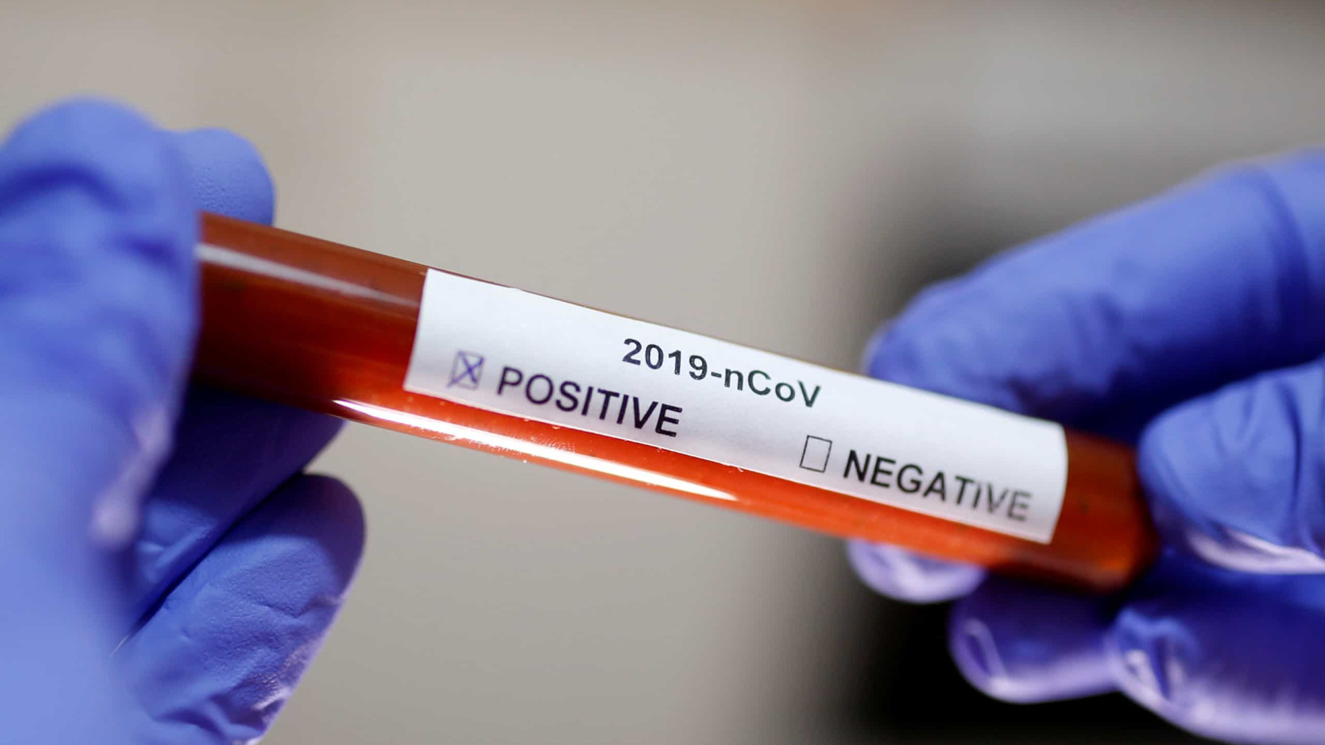Califórnia declara estado de emergência após primeira por coronavírus
