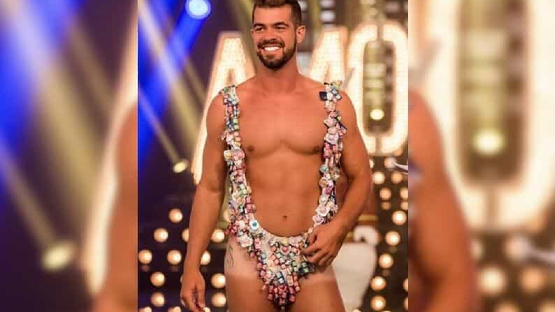 Bruno Miranda, o Borat de Amor e Sexo, segue em estado grave após ser baleado