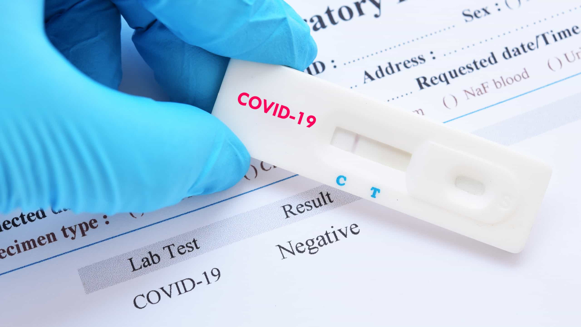 PF faz buscas em Oiapoque por desvios de testes de coronavírus