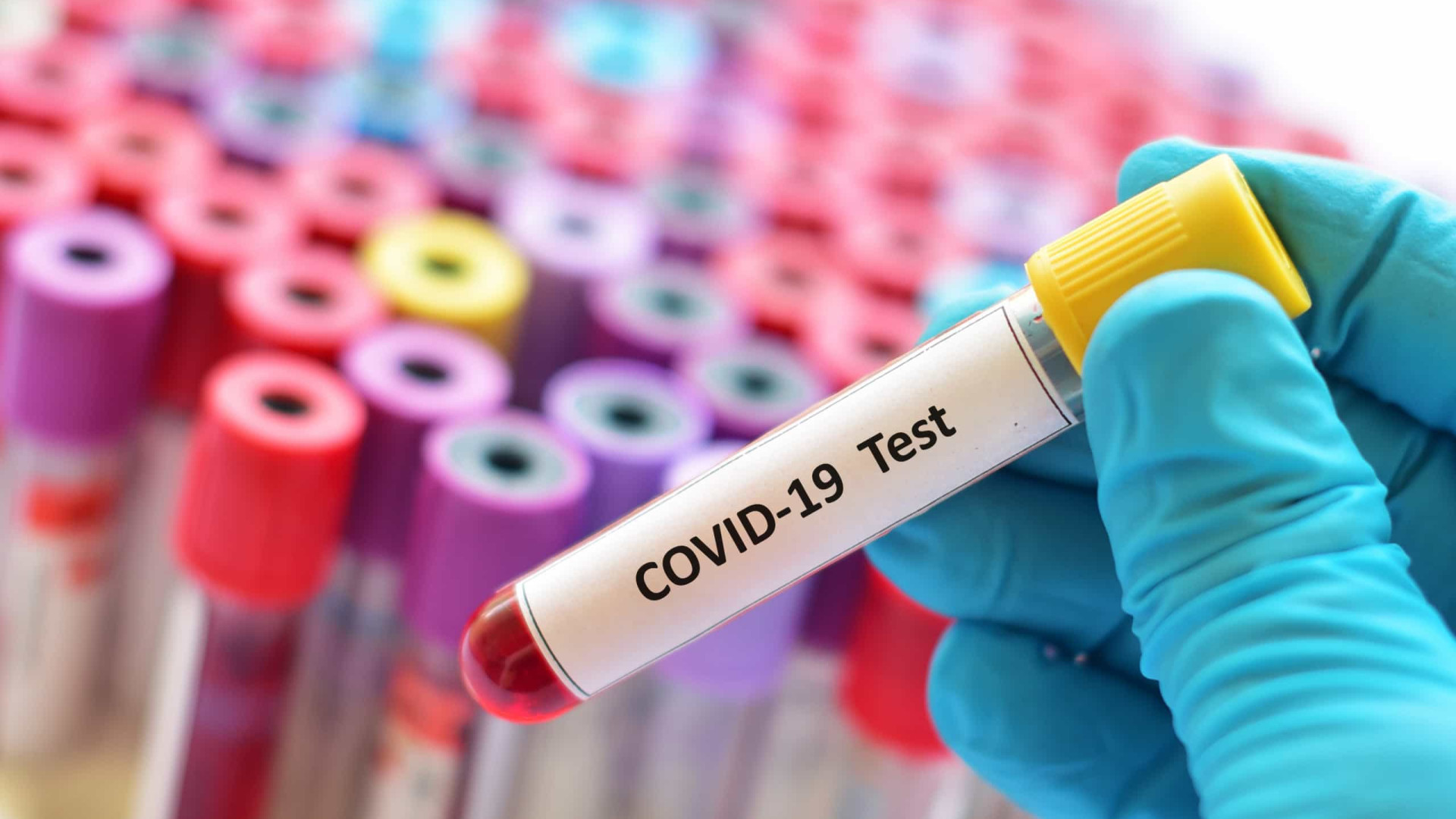 Governo estuda diagnóstico da covid-19 sem teste