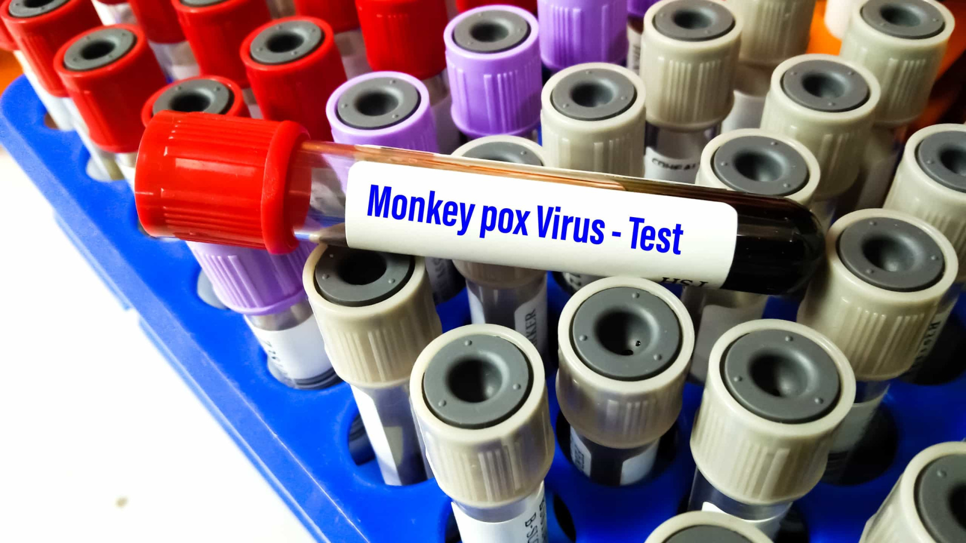 Varíola dos macacos: SP tem 2 grávidas e 5 crianças infectadas