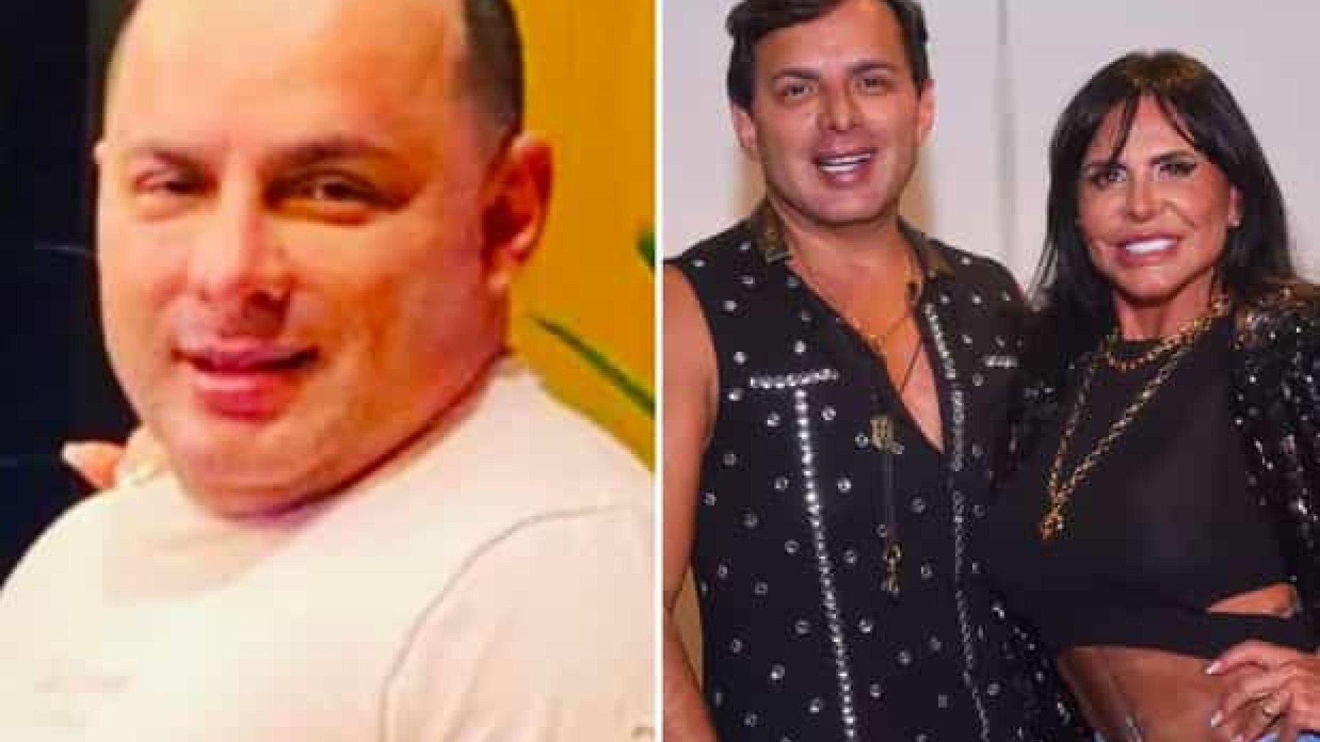 Marido de Gretchen surpreende ao mostrar antes e depois da harmonização ...