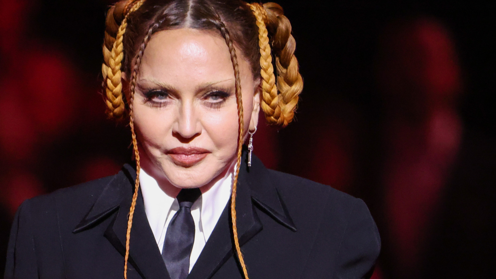 Madonna rebate críticas sobre rosto inchado