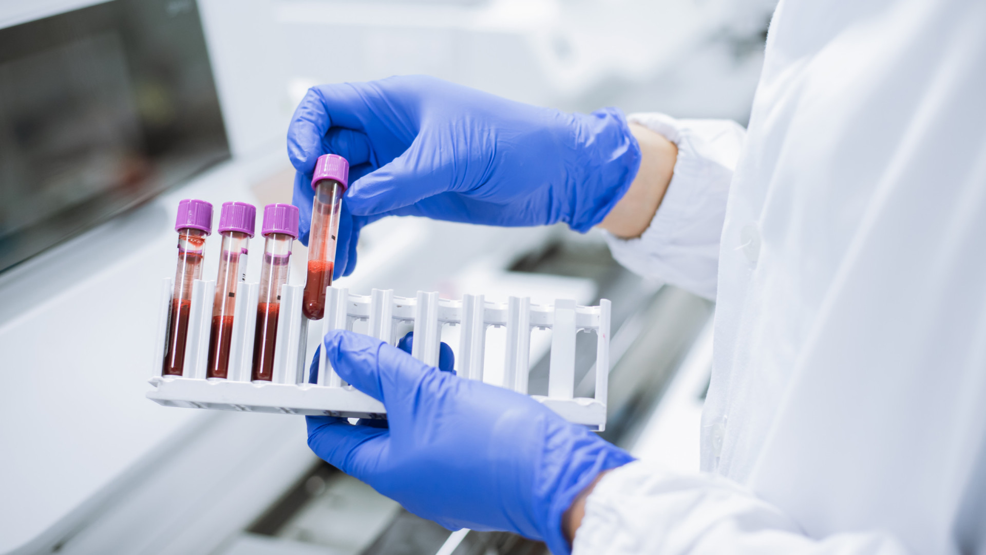 Novo teste de sangue consegue detectar risco de Alzheimer com precisão