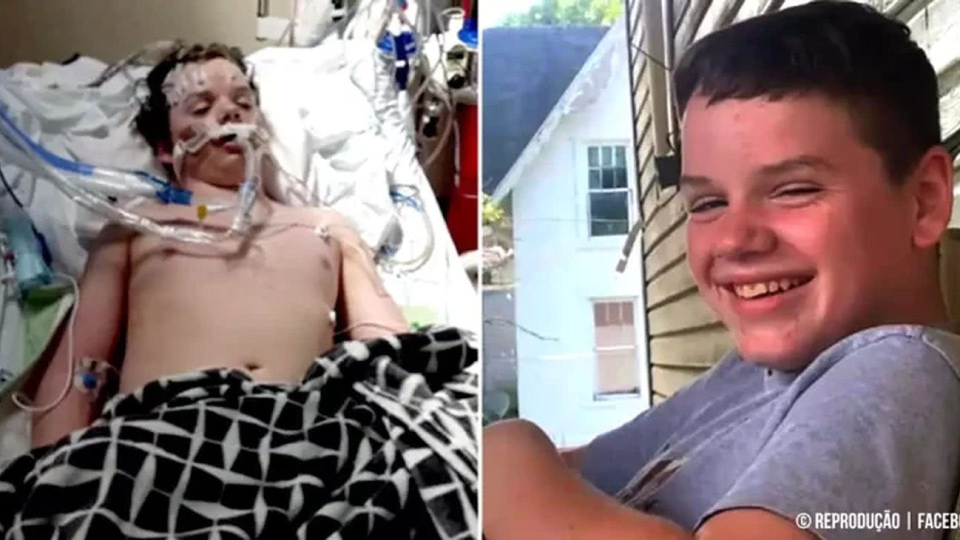 Menino de 13 anos morre após tomar antialérgicos para filmar desafio do TikTok