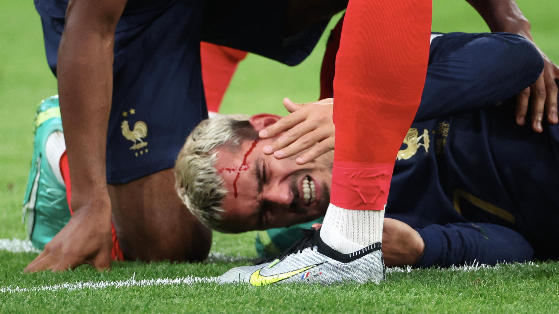 Griezmann fica com o rosto machucado após entrada arrepiante 
