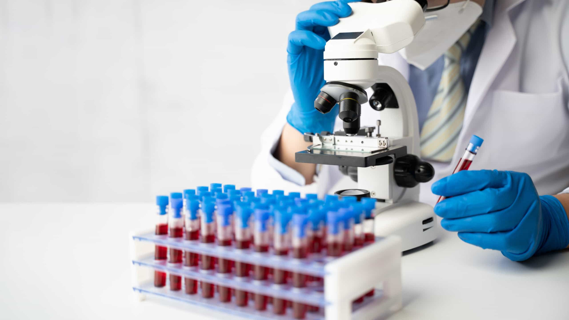 Novo teste de sangue pode determinar risco de AVC