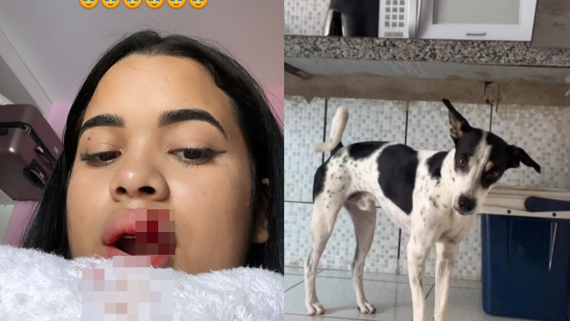 Influenciadora beija cachorro na boca e tem parte do lábio arrancado
