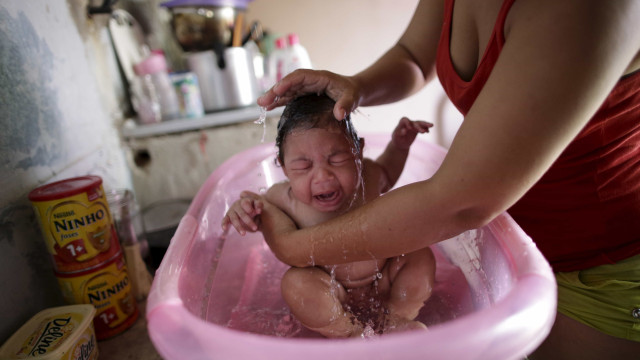 Bebês com microcefalia devem ter cuidado integral, 
alerta governo