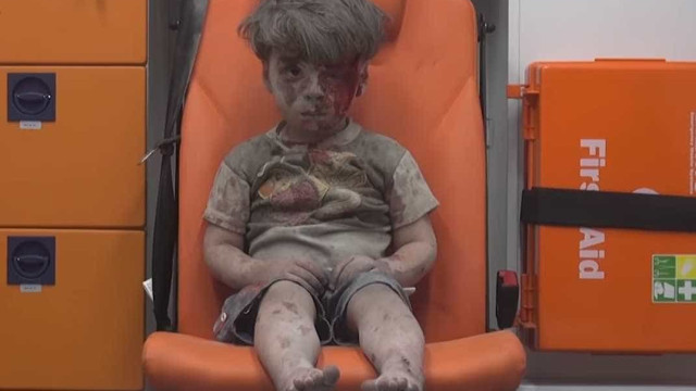 Em nova foto, menino símbolo da guerra na Síria reaparece recuperado
