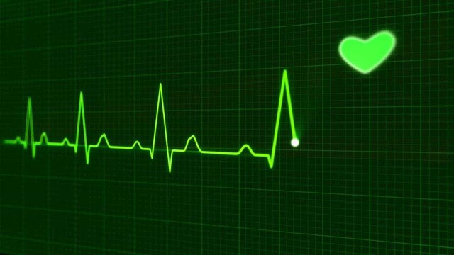 Entenda a importância do atendimento rápido em casos de infarto