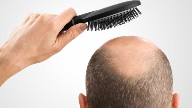 Alopecia atinge também barbas, sobrancelhas, bigode, cílios e até pelos