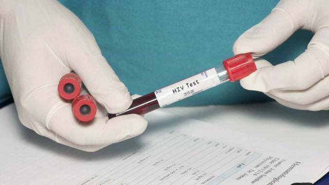 Cientistas detectam 2º caso de remissão total do HIV