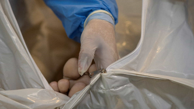 SARS-CoV-2 é detectado em gengivas de pacientes mortos no Brasil
