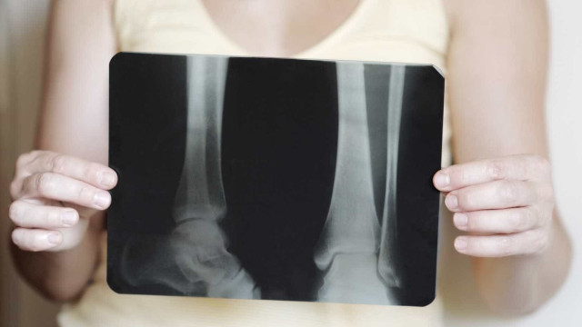 Estes 15 alimentos (ricos em cálcio) ajudam a prevenir a osteoporose
