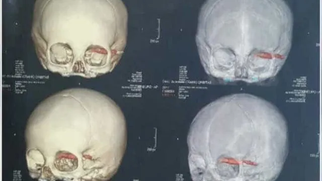 
                    Cientistas acham crânios de 2.000 anos, e detalhe nos dentes chama atenção
                