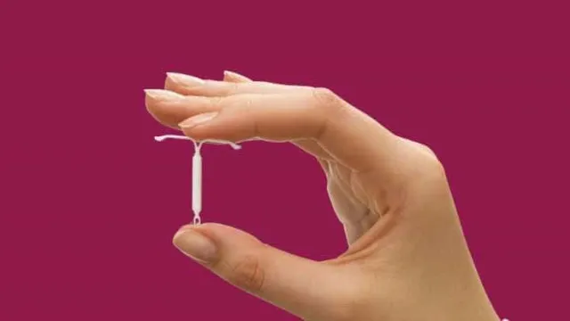 
                    Planos de saúde passam a cobrir DIU hormonal contra endometriose
                