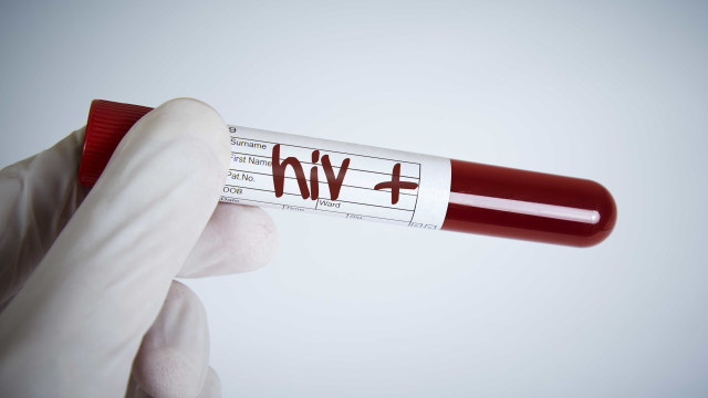 Pesquisadores desenvolvem nova abordagem para combater vírus da Aids