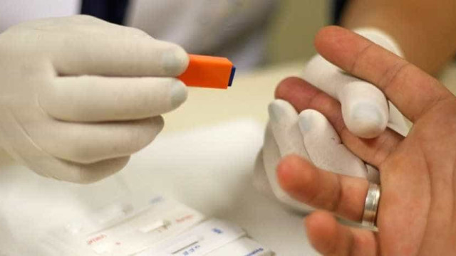 Em um ano, Covid já matou mais brasileiros do que a Aids em quase quatro décadas