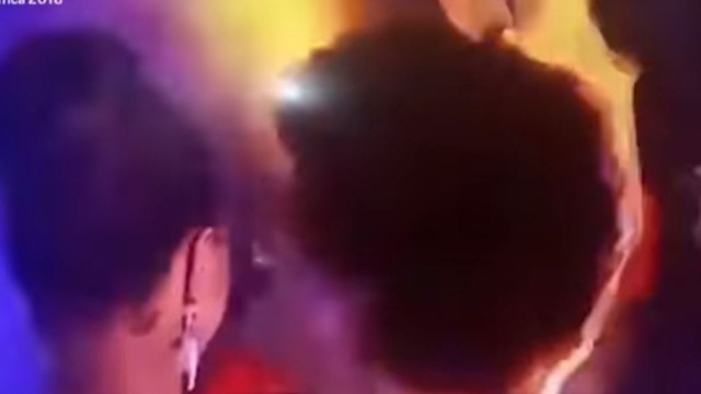 Miss África fica com cabelo em chamas durante comemoração