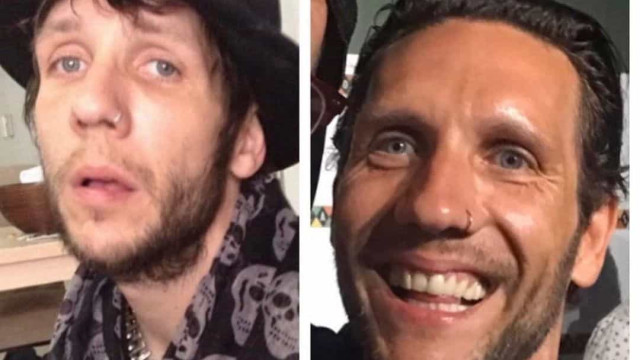 Estrela de 'Jackass' surpreende ao mostrar antes e depois das drogas