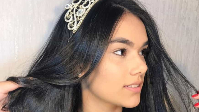 Miss Roraima Teen morre aos 21 anos durante cirurgia de emergência
