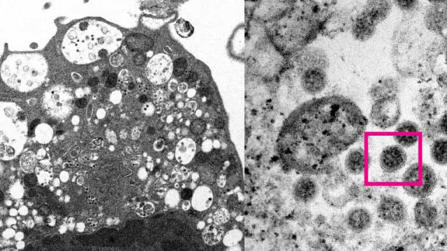Imagem da variante ômicron é capturada pela 1ª vez por cientistas