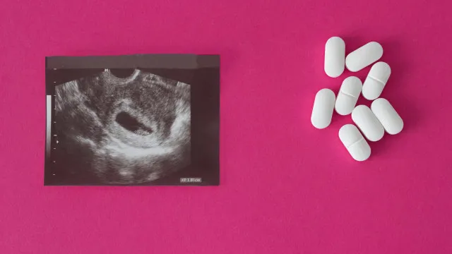
                    Metade das crianças grávidas com menos de 14 anos não recebe opção de aborto legal, diz pesquisa
                