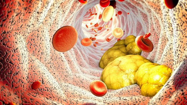 Oito erros comuns que fazem disparar (e muito) o colesterol
