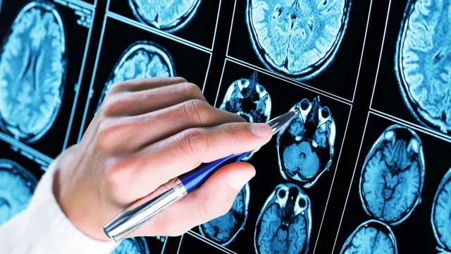 
                    Mais de 50% dos diagnósticos de autismo ocorrem antes dos 5 anos de idade
                