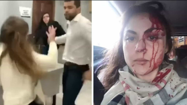 Ouvidor quer prisão do procurador que espancou procuradora-geral de Registro