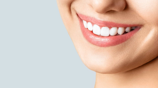 Clareamento dental: Mitos em que tem de deixar de acreditar