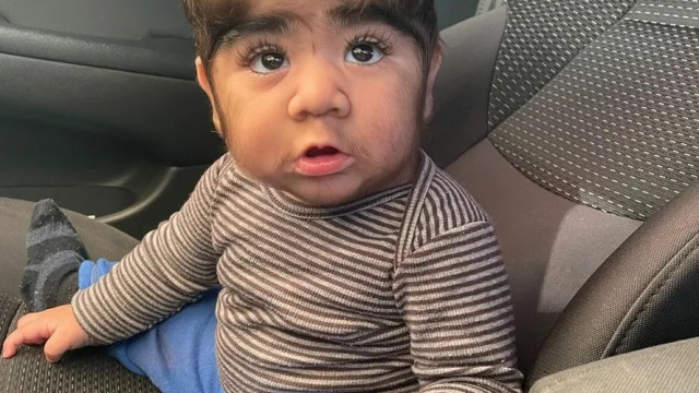  Bebê de 10 meses com barba viraliza nas redes sociais