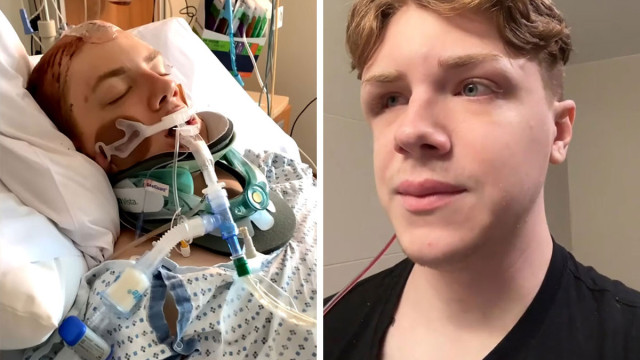  Jovem viraliza ao compartilhar sua recuperação após cirurgias cerebrais