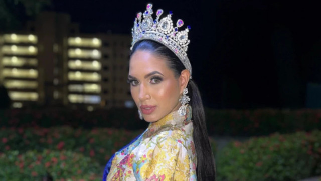  Ex-Miss Venezuela morre aos 24 anos após cirurgia na boca