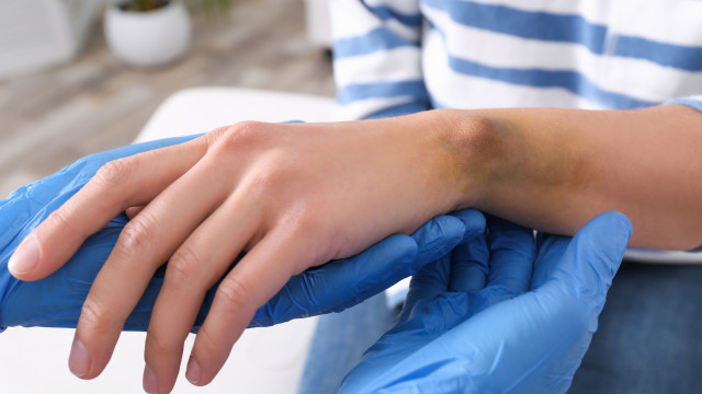 Médico sensibiliza: Leucemia pode se ver nas mãos; entenda