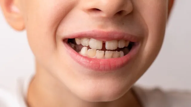 
                    Características que só herdamos da nossa mãe e as que só recebemos do pai
                