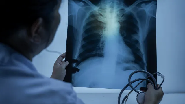 
                    Entenda quando uma infecção respiratória pode evoluir para pneumonia
                