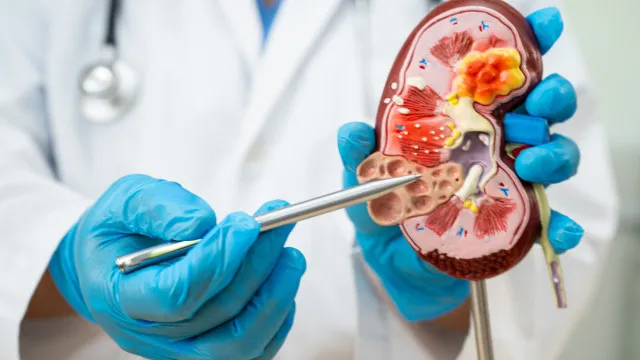 
                    Doença renal avança no país e expõe gargalos de acesso à diagnóstico precoce e à diálise
                