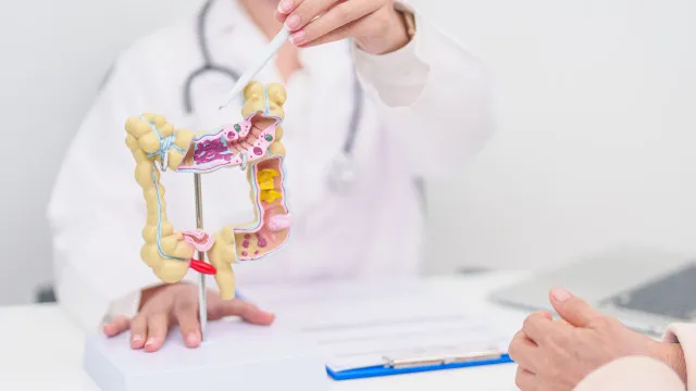 
                    Hábitos diários que podem ajudar a reduzir o risco de câncer colorretal
                